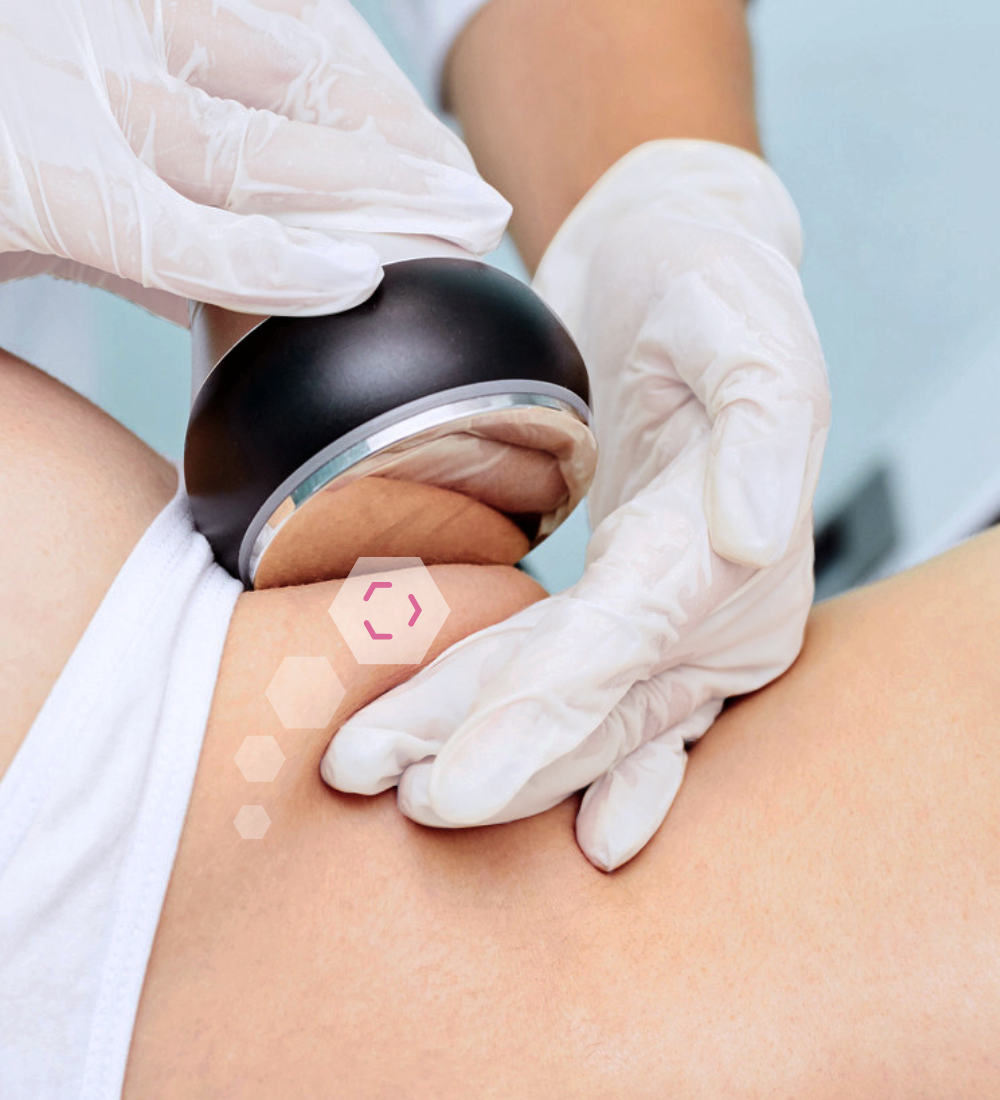 Body Shaping Abnehmen Hüfte im Kosmetikstudio Innsbruck - Detailansicht | INCEBEL Medical Beauty Institut