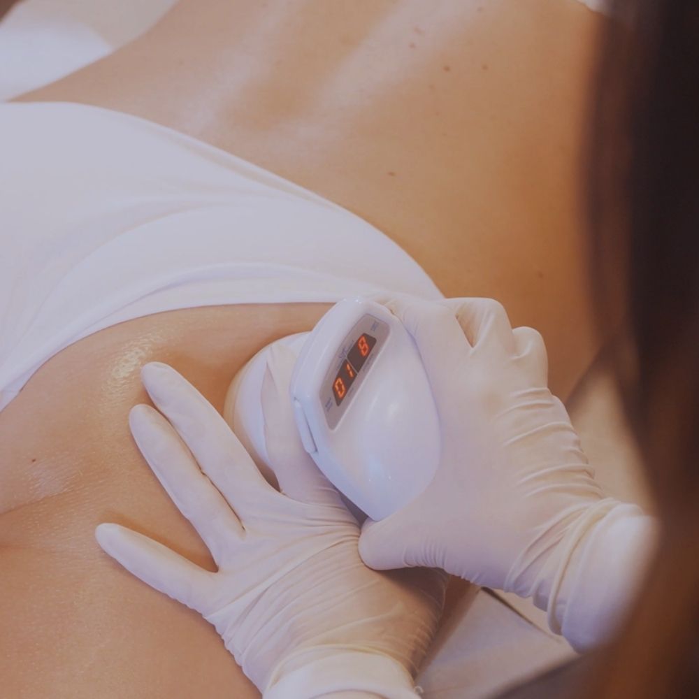 Cellulite reduzieren mit Body Shaping